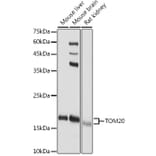 Western Blot - Anti-TOMM20 Antibody (A92833) - Antibodies.com