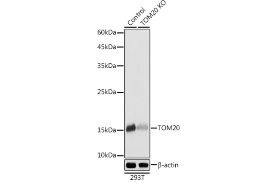 Western Blot - Anti-TOMM20 Antibody (A92833) - Antibodies.com