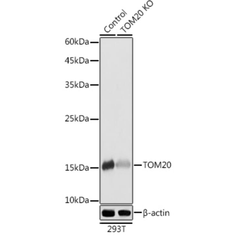 Western Blot - Anti-TOMM20 Antibody (A92833) - Antibodies.com