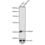 Western Blot - Anti-TOMM20 Antibody (A92833) - Antibodies.com