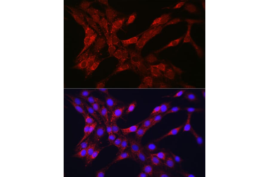 Immunofluorescence - Anti-TOMM20 Antibody (A92833) - Antibodies.com