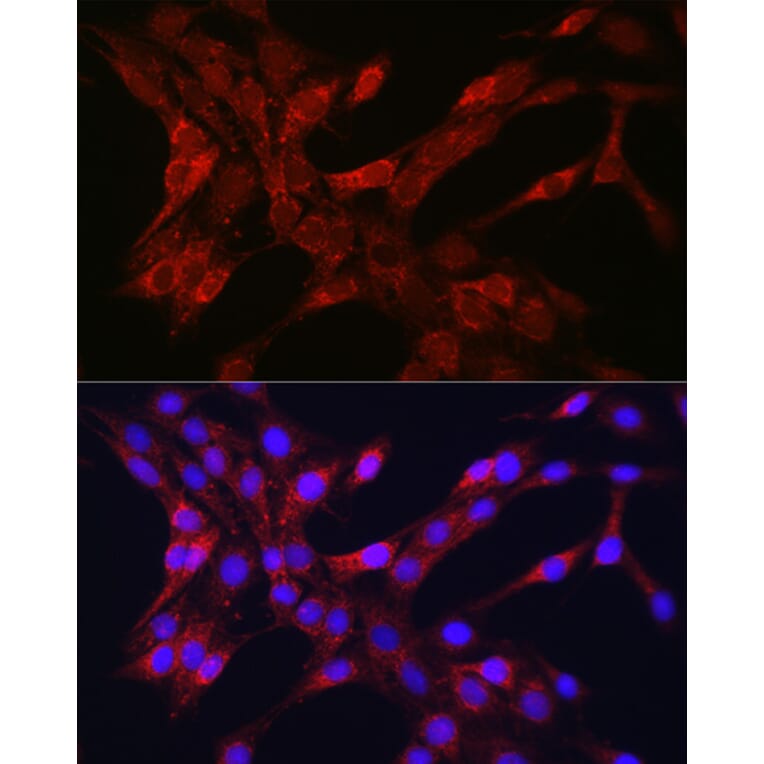 Immunofluorescence - Anti-TOMM20 Antibody (A92833) - Antibodies.com