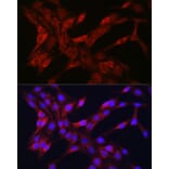 Immunofluorescence - Anti-TOMM20 Antibody (A92833) - Antibodies.com