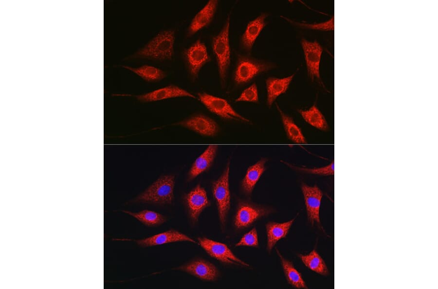 Immunofluorescence - Anti-TOMM20 Antibody (A92833) - Antibodies.com