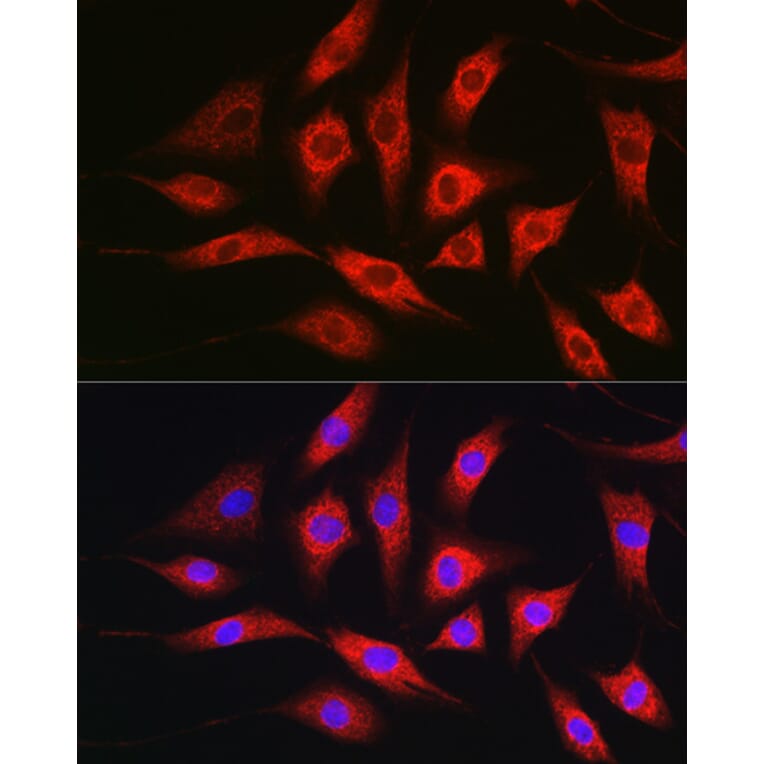 Immunofluorescence - Anti-TOMM20 Antibody (A92833) - Antibodies.com