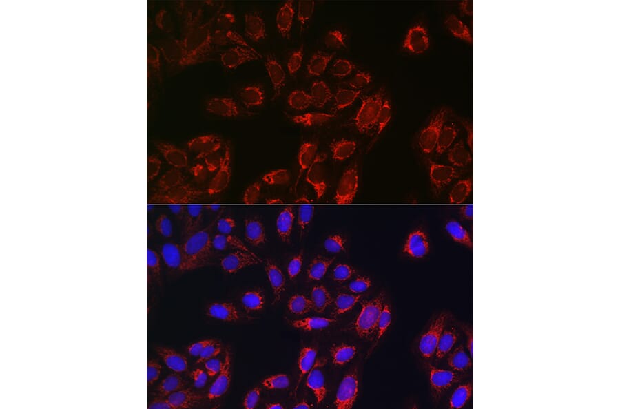 Immunofluorescence - Anti-TOMM20 Antibody (A92833) - Antibodies.com