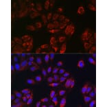 Immunofluorescence - Anti-TOMM20 Antibody (A92833) - Antibodies.com