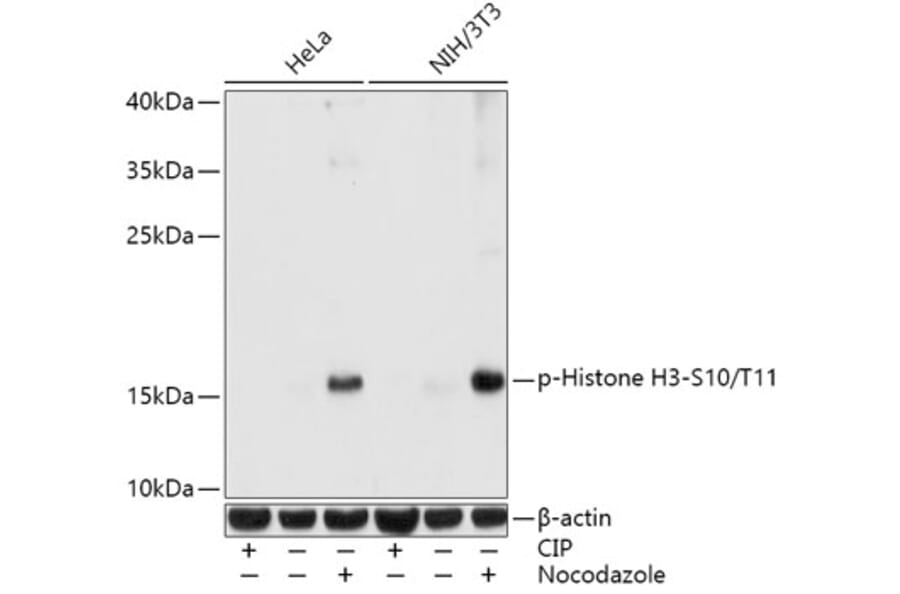 Western Blot - Anti-Histone H3 (phospho Ser10 + Thr11) Antibody (A92837) - Antibodies.com