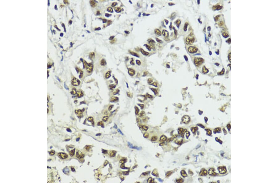 Immunohistochemistry - Anti-Histone H3 (phospho Ser10 + Thr11) Antibody (A92837) - Antibodies.com