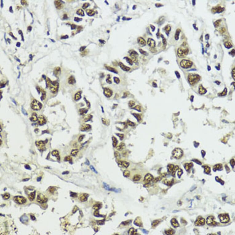 Immunohistochemistry - Anti-Histone H3 (phospho Ser10 + Thr11) Antibody (A92837) - Antibodies.com