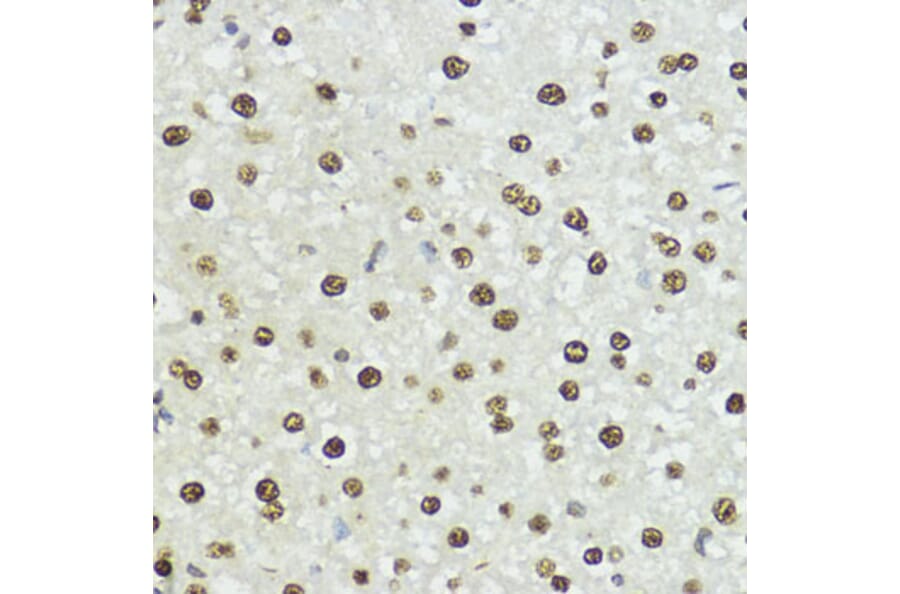 Immunohistochemistry - Anti-Histone H3 (phospho Ser10 + Thr11) Antibody (A92837) - Antibodies.com