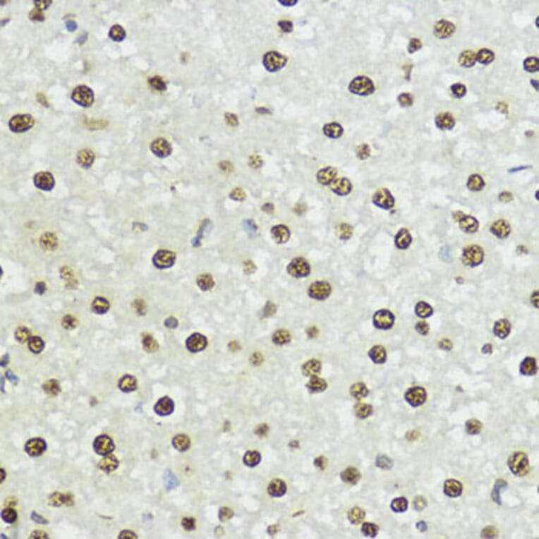 Immunohistochemistry - Anti-Histone H3 (phospho Ser10 + Thr11) Antibody (A92837) - Antibodies.com