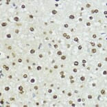 Immunohistochemistry - Anti-Histone H3 (phospho Ser10 + Thr11) Antibody (A92837) - Antibodies.com