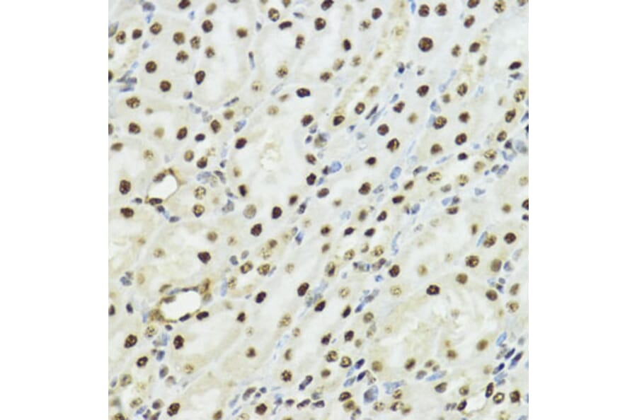 Immunohistochemistry - Anti-Histone H3 (phospho Ser10 + Thr11) Antibody (A92837) - Antibodies.com