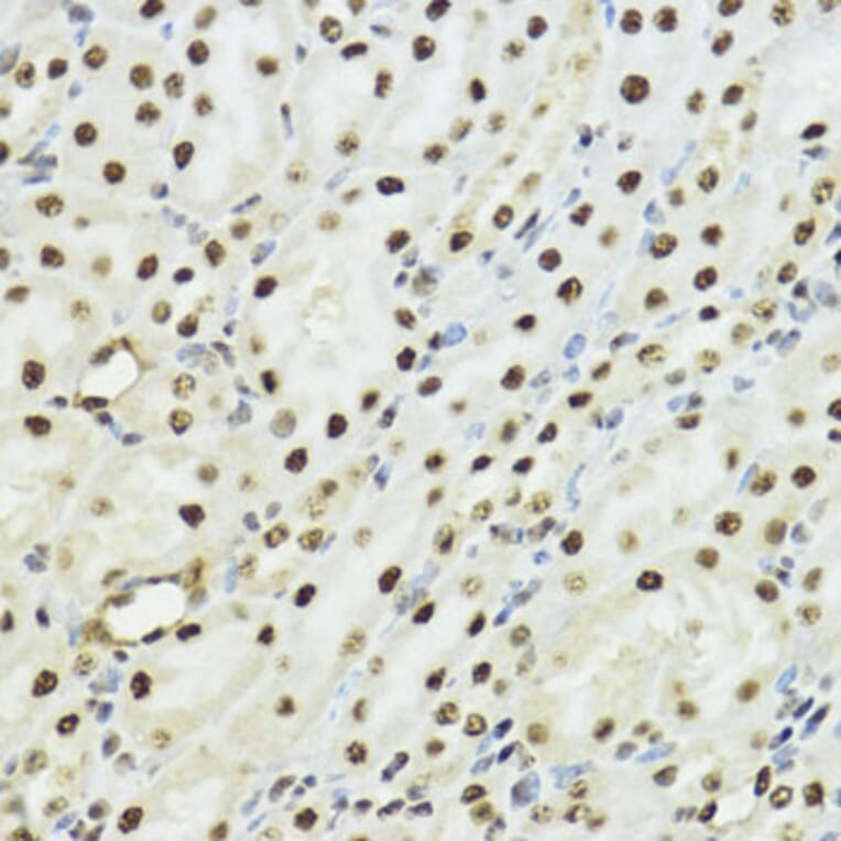 Immunohistochemistry - Anti-Histone H3 (phospho Ser10 + Thr11) Antibody (A92837) - Antibodies.com
