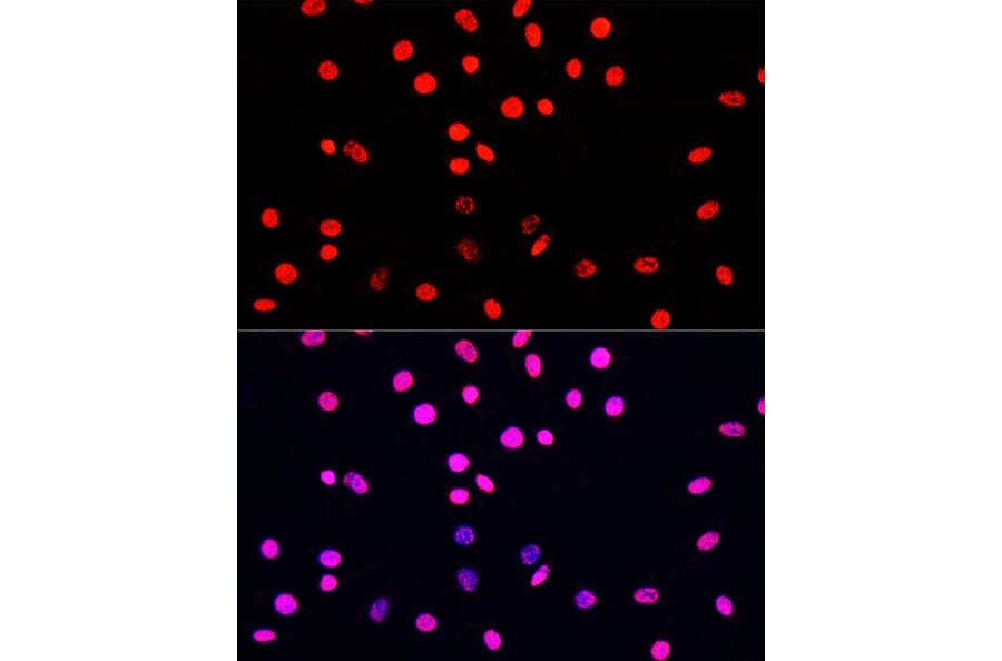 Immunofluorescence - Anti-Histone H3 (phospho Ser10 + Thr11) Antibody (A92837) - Antibodies.com