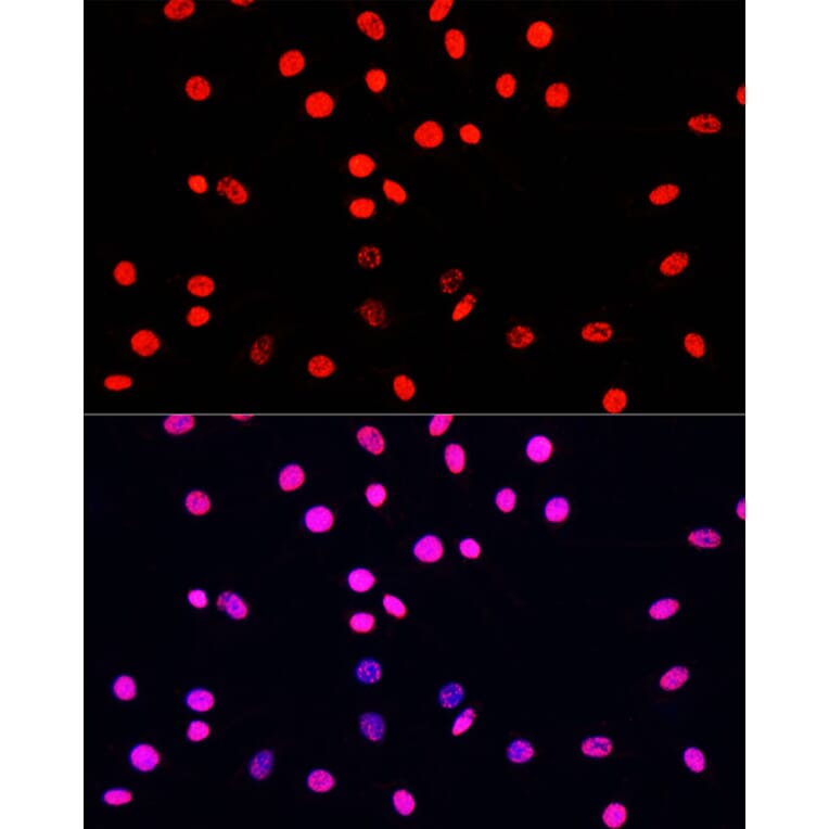 Immunofluorescence - Anti-Histone H3 (phospho Ser10 + Thr11) Antibody (A92837) - Antibodies.com