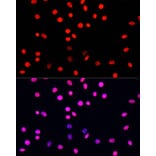Immunofluorescence - Anti-Histone H3 (phospho Ser10 + Thr11) Antibody (A92837) - Antibodies.com