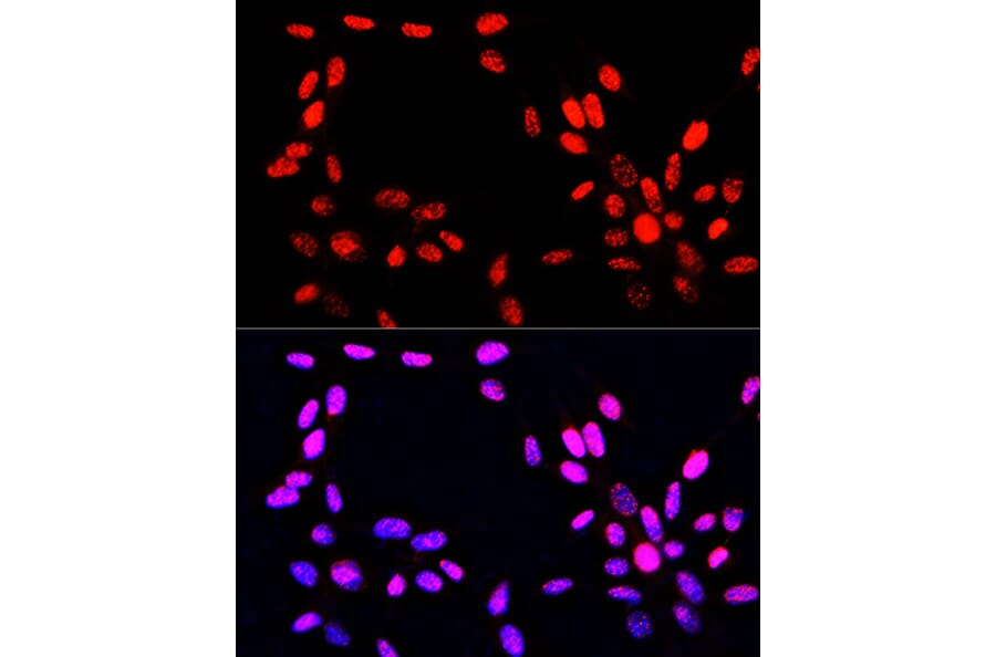 Immunofluorescence - Anti-Histone H3 (phospho Ser10 + Thr11) Antibody (A92837) - Antibodies.com