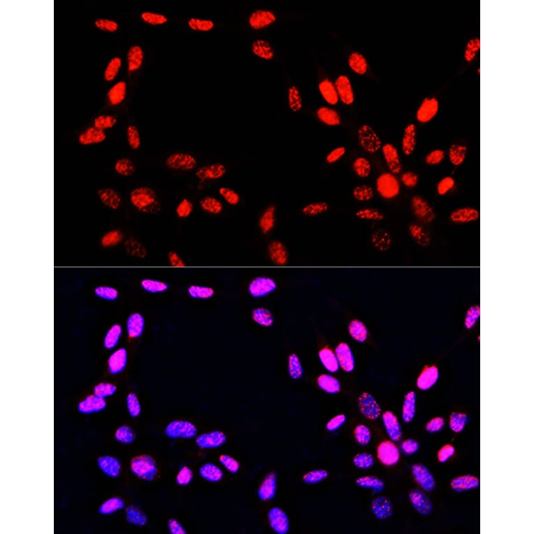 Immunofluorescence - Anti-Histone H3 (phospho Ser10 + Thr11) Antibody (A92837) - Antibodies.com