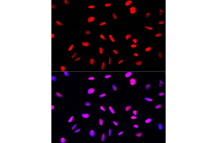 Immunofluorescence - Anti-Histone H3 (phospho Ser10 + Thr11) Antibody (A92837) - Antibodies.com