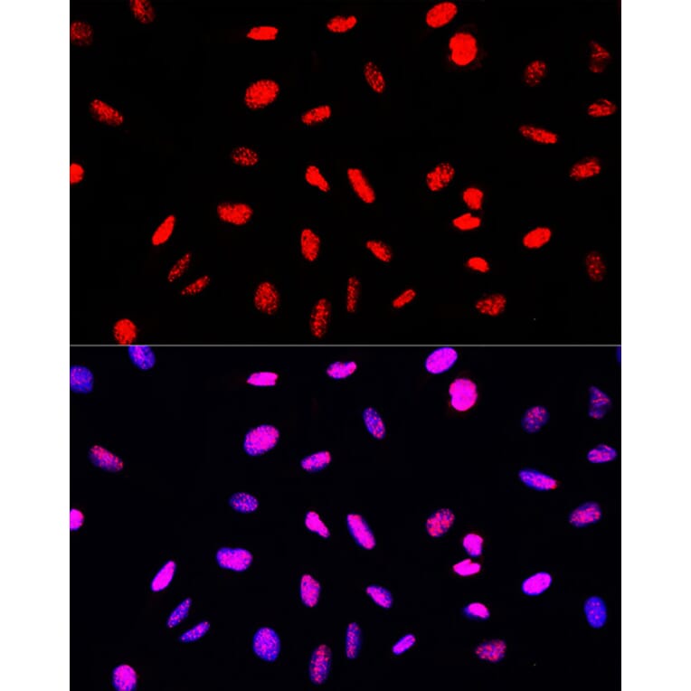 Immunofluorescence - Anti-Histone H3 (phospho Ser10 + Thr11) Antibody (A92837) - Antibodies.com
