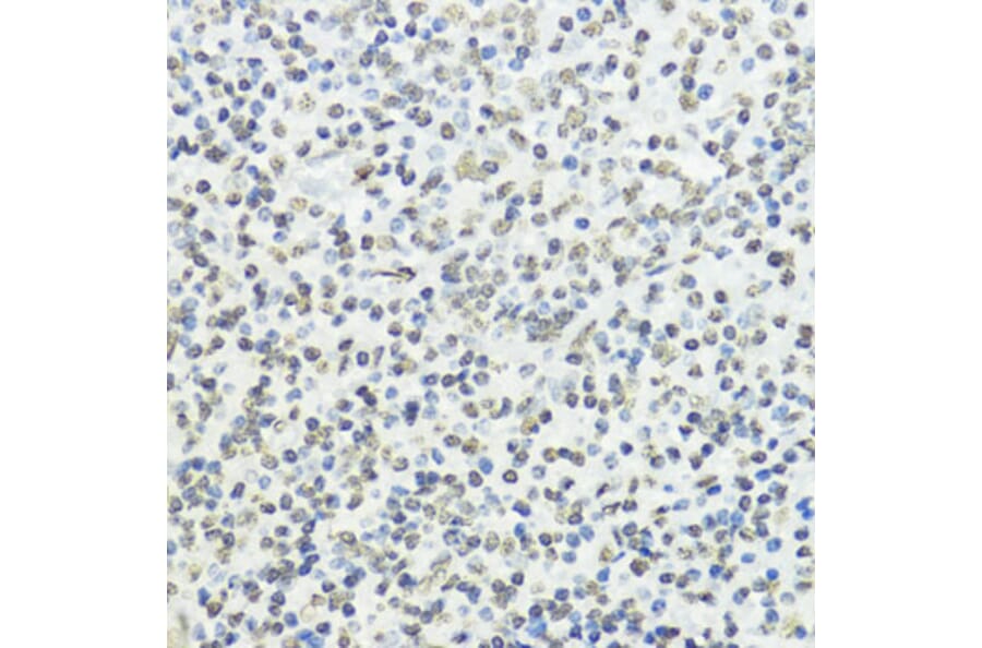 Immunohistochemistry - Anti-Histone H3 (phospho Thr45) Antibody (A92838) - Antibodies.com