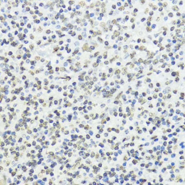 Immunohistochemistry - Anti-Histone H3 (phospho Thr45) Antibody (A92838) - Antibodies.com