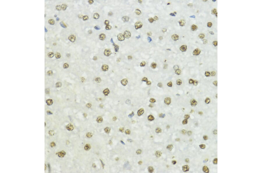 Immunohistochemistry - Anti-Histone H3 (phospho Thr45) Antibody (A92838) - Antibodies.com