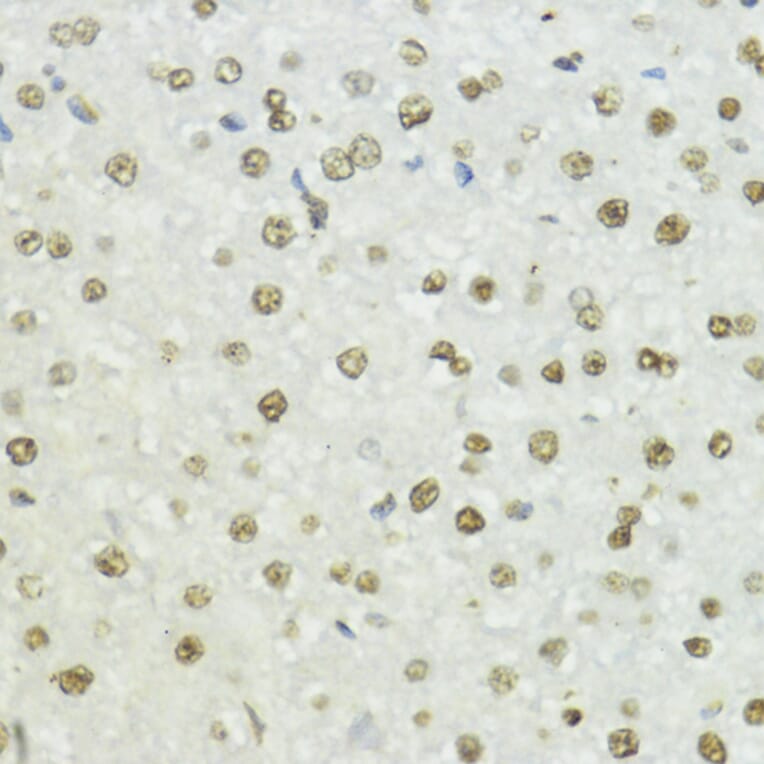 Immunohistochemistry - Anti-Histone H3 (phospho Thr45) Antibody (A92838) - Antibodies.com