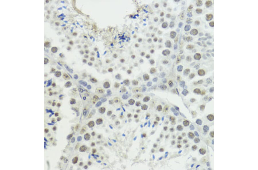 Immunohistochemistry - Anti-Histone H3 (phospho Thr45) Antibody (A92838) - Antibodies.com