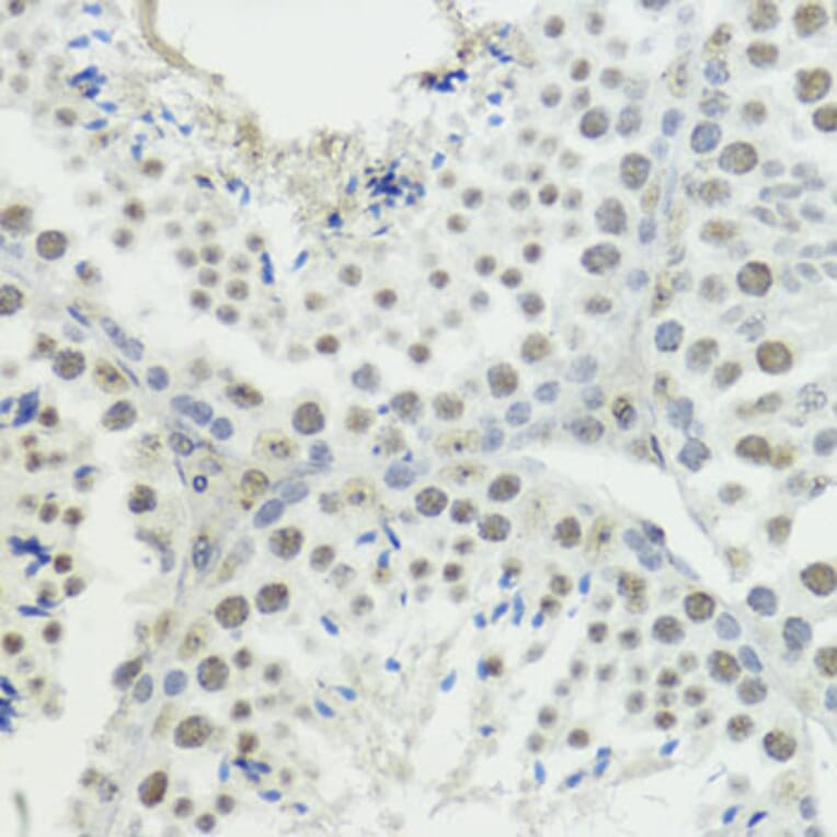 Immunohistochemistry - Anti-Histone H3 (phospho Thr45) Antibody (A92838) - Antibodies.com