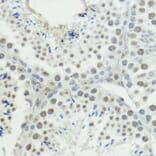Immunohistochemistry - Anti-Histone H3 (phospho Thr45) Antibody (A92838) - Antibodies.com