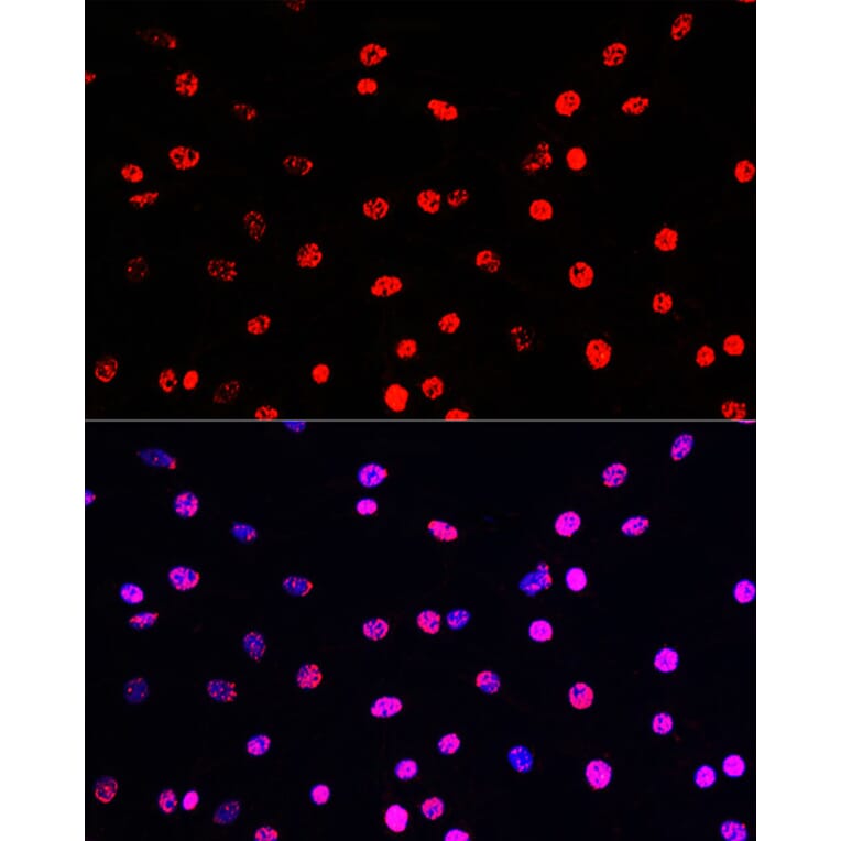Immunofluorescence - Anti-Histone H3 (phospho Thr45) Antibody (A92838) - Antibodies.com