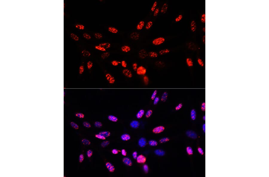 Immunofluorescence - Anti-Histone H3 (phospho Thr45) Antibody (A92838) - Antibodies.com