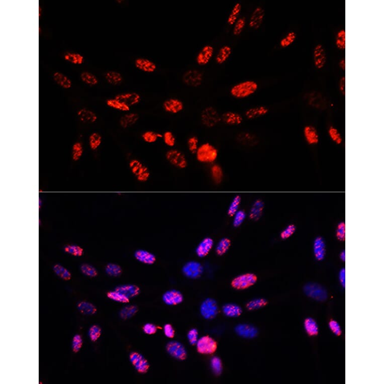 Immunofluorescence - Anti-Histone H3 (phospho Thr45) Antibody (A92838) - Antibodies.com