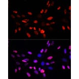 Immunofluorescence - Anti-Histone H3 (phospho Thr45) Antibody (A92838) - Antibodies.com