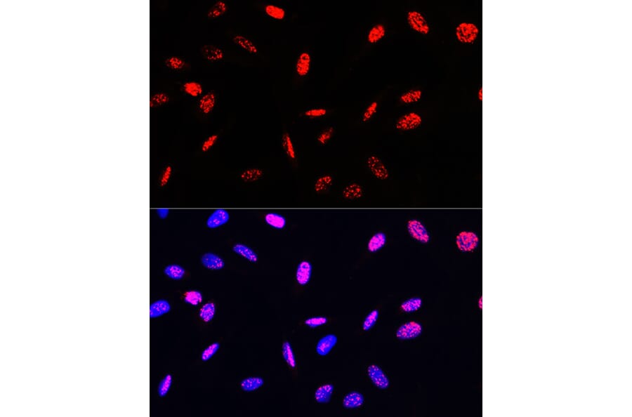 Immunofluorescence - Anti-Histone H3 (phospho Thr45) Antibody (A92838) - Antibodies.com