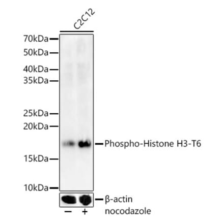Western Blot - Anti-Histone H3 (Phospho T6) Antibody (A92839) - Antibodies.com