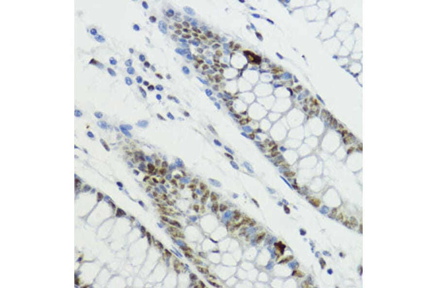 Immunohistochemistry - Anti-Histone H3 (Phospho T6) Antibody (A92839) - Antibodies.com