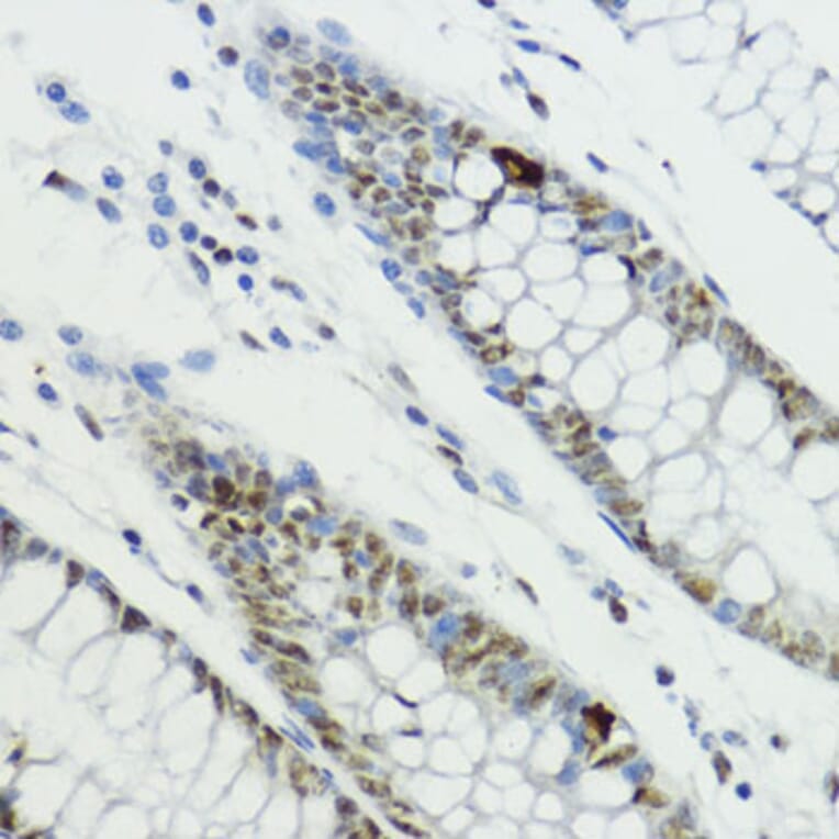 Immunohistochemistry - Anti-Histone H3 (Phospho T6) Antibody (A92839) - Antibodies.com