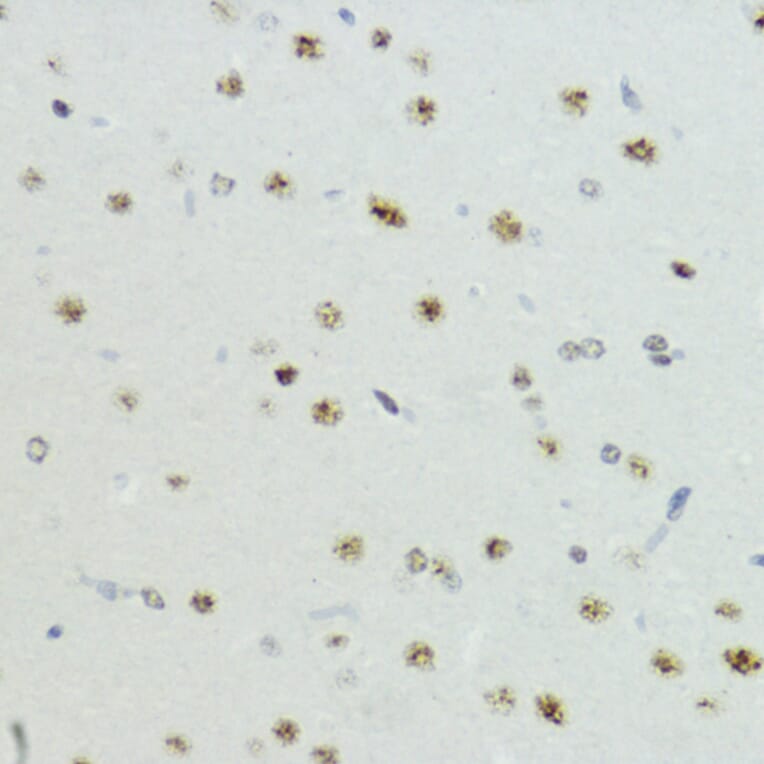 Immunohistochemistry - Anti-Histone H3 (Phospho T6) Antibody (A92839) - Antibodies.com