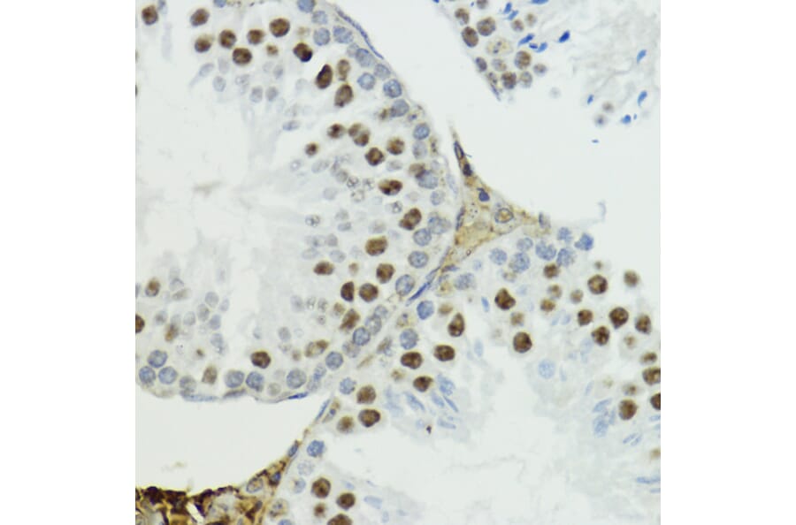 Immunohistochemistry - Anti-Histone H3 (Phospho T6) Antibody (A92839) - Antibodies.com