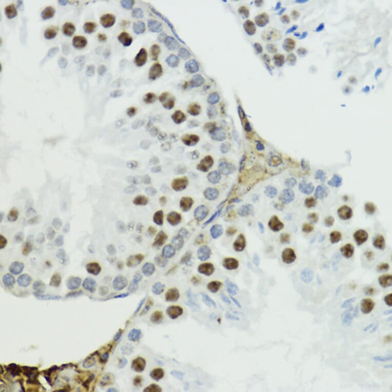 Immunohistochemistry - Anti-Histone H3 (Phospho T6) Antibody (A92839) - Antibodies.com