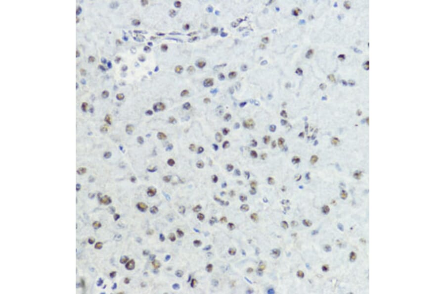 Immunohistochemistry - Anti-Histone H3 (Phospho T6) Antibody (A92839) - Antibodies.com
