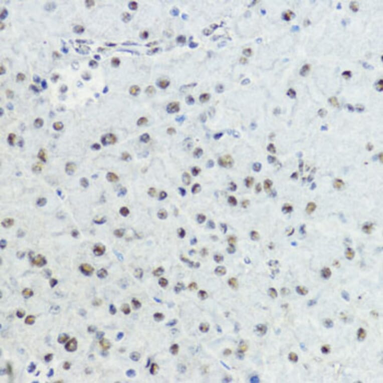 Immunohistochemistry - Anti-Histone H3 (Phospho T6) Antibody (A92839) - Antibodies.com