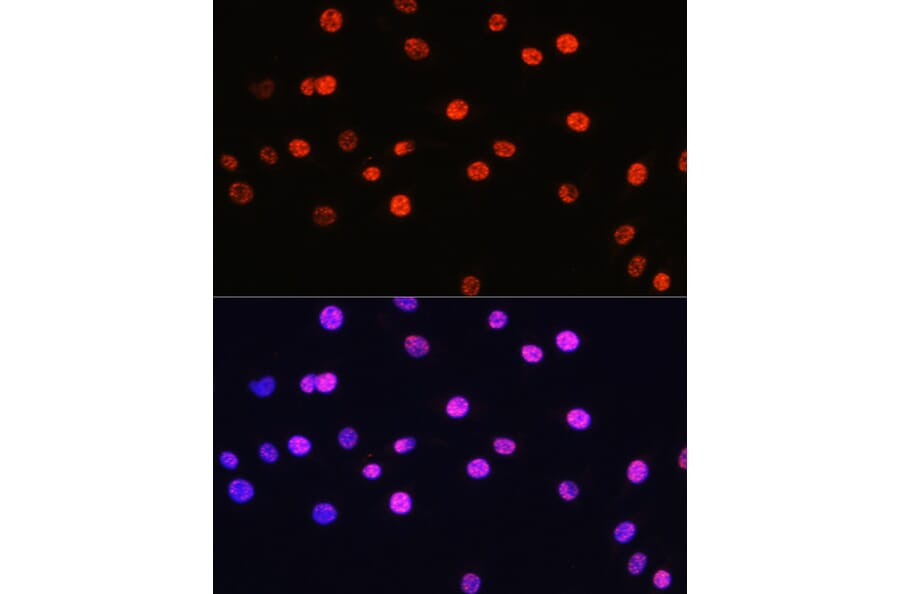 Immunofluorescence - Anti-Histone H3 (Phospho T6) Antibody (A92839) - Antibodies.com