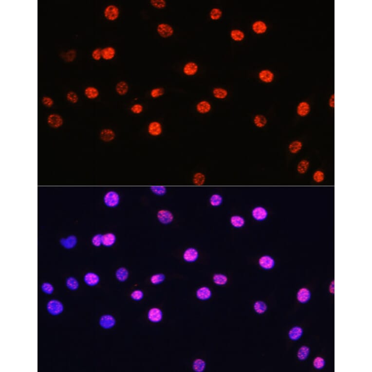 Immunofluorescence - Anti-Histone H3 (Phospho T6) Antibody (A92839) - Antibodies.com
