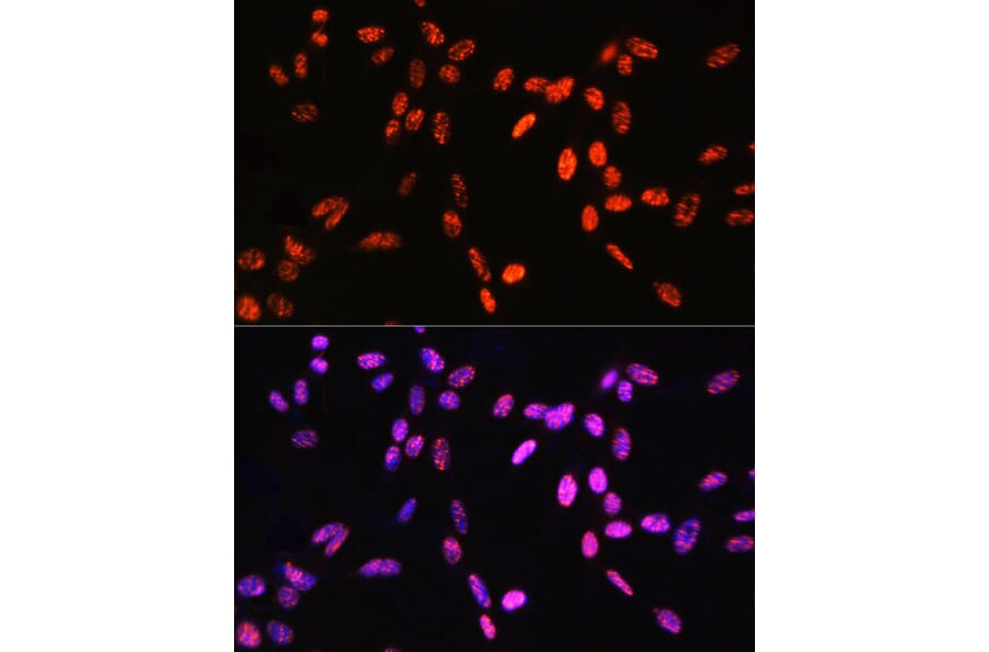 Immunofluorescence - Anti-Histone H3 (Phospho T6) Antibody (A92839) - Antibodies.com
