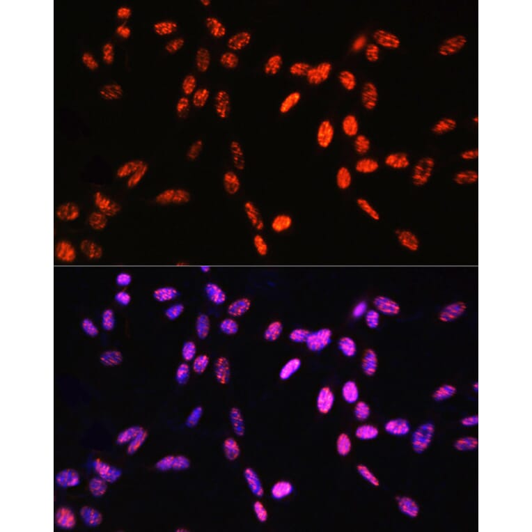 Immunofluorescence - Anti-Histone H3 (Phospho T6) Antibody (A92839) - Antibodies.com
